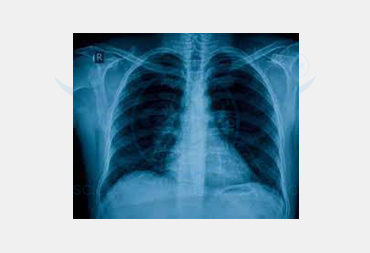 MEDICAL X-RAY FILM