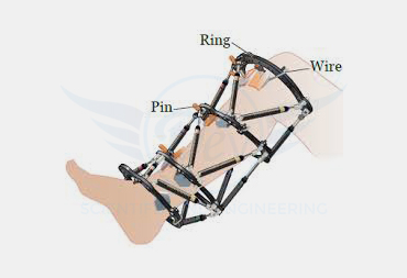 EXTERNAL FIXATORS
