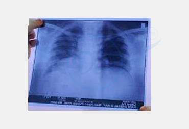 X-RAY SCREEN